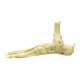 Nasco MG29758 Foot and Ankle with Plantar Fasciitis Model, Close-up Right Side View