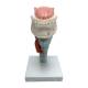 Nasco MG29773 Larynx with Tongue and Teeth Model, 5-Part, Front View
