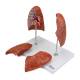 Nasco MG29786 Lung Model, 4-Part, Disassembled