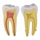 Nasco MG29802 Lower Molar Tooth Model, 2 Parts - Internal Part