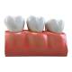 Nasco MG29837 Dental Morphology Model, 4x Enlarged, 7 Parts - Front View