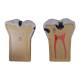 Nasco MG29837 Dental Morphology Model, 4x Enlarged, 7 Parts - Internal Part 1