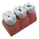 Nasco MG29837 Dental Morphology Model, 4x Enlarged, 7 Parts - Right Angle