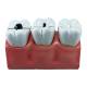 Nasco MG29837 Dental Morphology Model, 4x Enlarged, 7 Parts - Top View