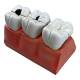 Nasco MG29837 Dental Morphology Model, 4x Enlarged, 7 Parts - Left Angle
