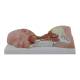 Nasco MG29872 Neck Muscles with Nerves Model - Angle 2