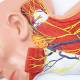 Nasco MG29872 Neck Muscles with Nerves Model - Angle 3