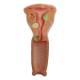 Nasco MG29947 Female Genital Organ with Pathology Model, 2 Parts - Vagina to Uterus