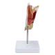 Nasco MG29949 Male Genital Organ with Pathology Model, 2 Parts - Back View
