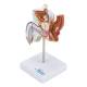 Nasco MG29949 Male Genital Organ with Pathology Model, 2 Parts - Left Angle