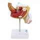 Nasco MG29949 Male Genital Organ with Pathology Model, 2 Parts - Side View 2