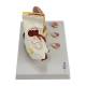 Nasco MG29985 Ear with Pathology Model, 1.5x Enlarged, Left Side View