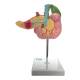 Nasco MG30031 Pancreas, Duodenum, and Gallbladder with Pathologies Model - Back View