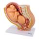 Nasco MG30131 Pelvis with Pregnancy Model, 2 Parts - Angle 1