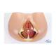 Nasco MG30414 Female Perineum Model
