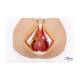 Nasco MG30415 Male Perineum Model