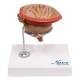 Nasco MG30752 Prostate Model, 2x Enlarged, 4 Parts