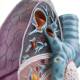 Nasco MG30885 Lung Pathology Model, 1.5x Enlarged, Brochus Close-up View