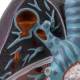 Nasco MG30885 Lung Pathology Model, 1.5x Enlarged, Cavity Pathology Close-up View