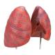 Nasco MG30887 Lung Model, 2-Part, Close-up View