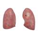 Nasco MG30888 Lung Model with Larynx, 7-Part, Removable Lungs