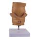 Nasco MG31005 Hemorrhoids Model, 5x Enlarged - Back View