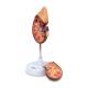 Nasco MG31016 Kidney with Adrenal Gland Model, 1.5x Enlarged, 2 Parts - Left Angle View with Detached Part