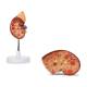 Nasco MG31016 Kidney with Adrenal Gland Model, 1.5x Enlarged, 2 Parts - Upright and Detached View