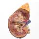 Nasco MG31017 Kidney with Adrenal Gland Model, 2 Parts - Top Cross-section View