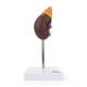 Nasco MG31017 Kidney with Adrenal Gland Model, 2 Parts