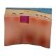 Nasco MG31097 Trachea Section Model, Skin Block