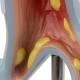 Nasco MG31098 Bronchial Tree Section Pathology Model, 10x Enlarged, Carina Close-up View
