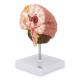 Nasco MG31100 Brain Section with Pathology Model - Angle 2