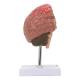 Nasco MG31100 Brain Section with Pathology Model - Angle 3