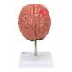 Nasco MG31100 Brain Section with Pathology Model - Angle 4