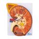 Nasco MG31103 Kidney Section with Adrenal Gland Model, 3x Enlarged