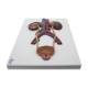 Nasco MG31104 Urinary System Section Model - Low Angle Inferior View