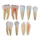 Nasco MG31151 Teeth Models, 10x Enlarged, 5 Parts - Set