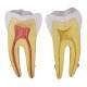 Nasco MG31151 Teeth Models, 10x Enlarged, 5 Parts - Internal Part Angle 2