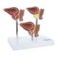 Nasco MG31153 Normal and Pathological Prostate Model, 3 Parts - Front View