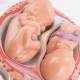 Nasco MG31154 Pregnancy Series Models - 5-Month-Old Twins