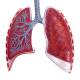 Nasco MG31336 Respiratory System with Alveoli Model, 150x Enlarged, Lungs