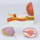 Nasco MG34924 Prostate with Pathology Model - Disassembled