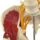 Nasco MG35509 Hip with Muscles and Sciatic Nerve Model - Angle 1