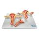 Nasco MG35528 Healthy and Pathological Uterus Models - Front View