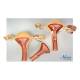Nasco MG35528 Healthy and Pathological Uterus Models - Top View