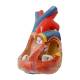 Nasco MG35530 Heart with Arteriosclerosis Model, Heart Left Angle View