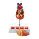 Nasco MG35530 Heart with Arteriosclerosis Model, Disassembled