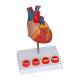 Nasco MG35530 Heart with Arteriosclerosis Model