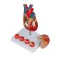 Nasco MG35530 Heart with Arteriosclerosis Model, Disassembled Left Angle View